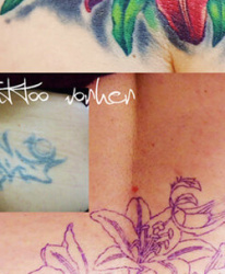 001 Cover Up Galerie Start Skinworxx Hamburg Tattoostudio